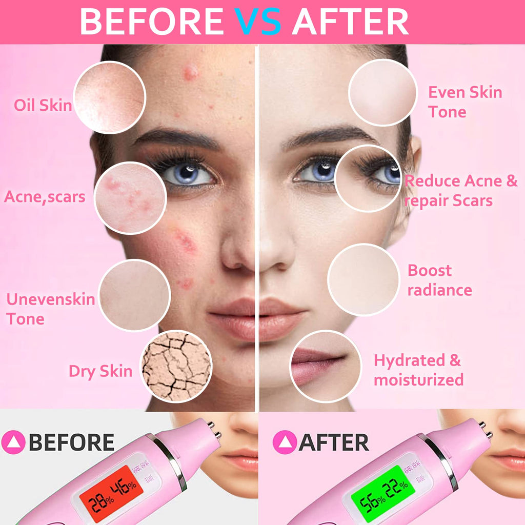 Ouhans Jelly Mask Powder for Facials Care,Rose Petals Gel Jelly Face Mask,Professional Peel off Rubber Mask,Hydrating Jelly Masks,DIY Spa Mask with Double-ended Silicone Brush,23 Fl Oz