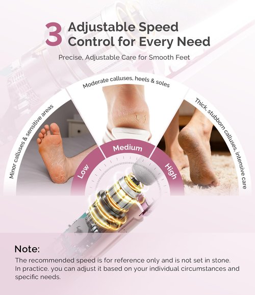 MelodySusie Electric Callus Remover for Feet, PC800G IPX7 Waterproof Rechargeable Pedicure Tool with LED Light & 3 Grits Roller Heads & Adjustable Speeds, for Dead Skin & Cracked Heel, Pink Rose