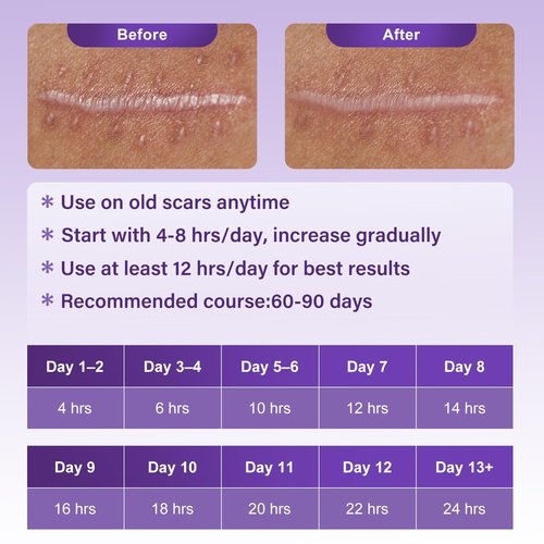 Scar Tape for Surgical Scars – Medical Grade Silicone Scar Sheets and Scar Tape for Keloid Removal, C Section Recovery, Tummy Tuck, Burn or Injury Marks, Soft Reusable Silicone Strips (1.6" x 60")