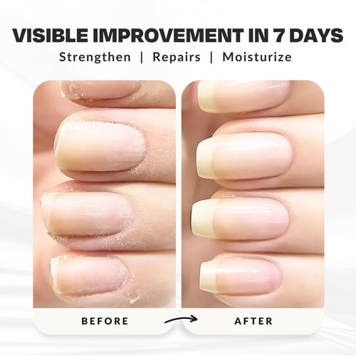 Nail Strengthener Power Boost Growth Formula, Keratin, Biotin, & Vitamin E, 21- Free, Repairs Damaged Nails, Stops Peeling & Chipping, Use as Clear Base Coat & Topcoat .50 fl. Oz. CAKE Nail Treatment