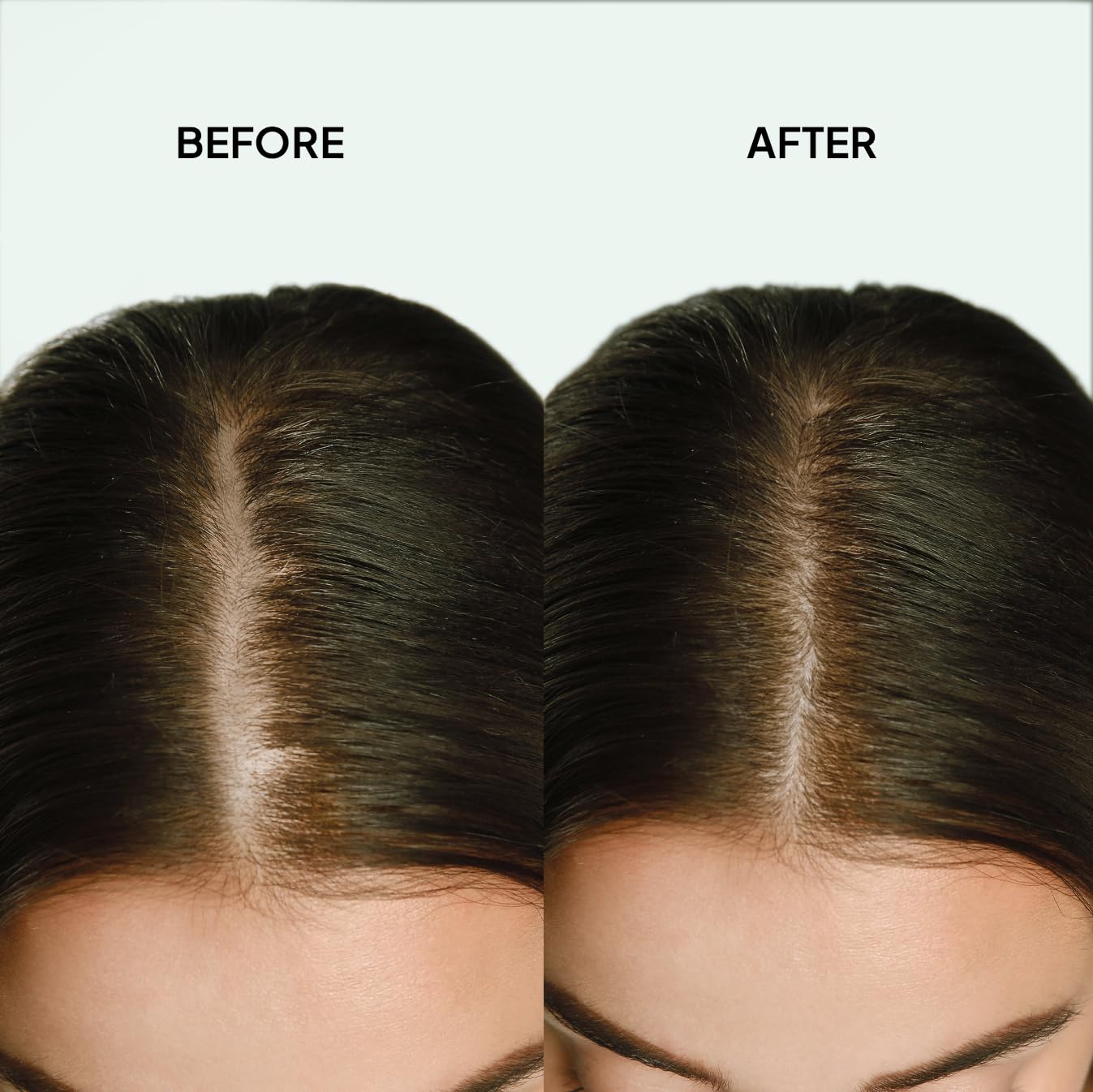 COBA’S DAUGHTER Redensyl Hair Growth Formula for Hair Loss | Hair Thickening scalp Refresher Spray | Biotin Hair Serum | Keratin, Chia Peptides | Fuller for Men and Women | Vegan (3.3oz)