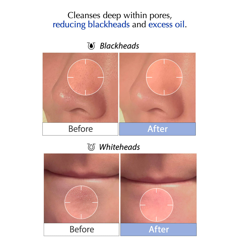 liv.reome MSM Sulfur Deep Pore Cleanser – Low pH Barrier-Respecting Face Wash, Pore Reset for Sensitive Skin