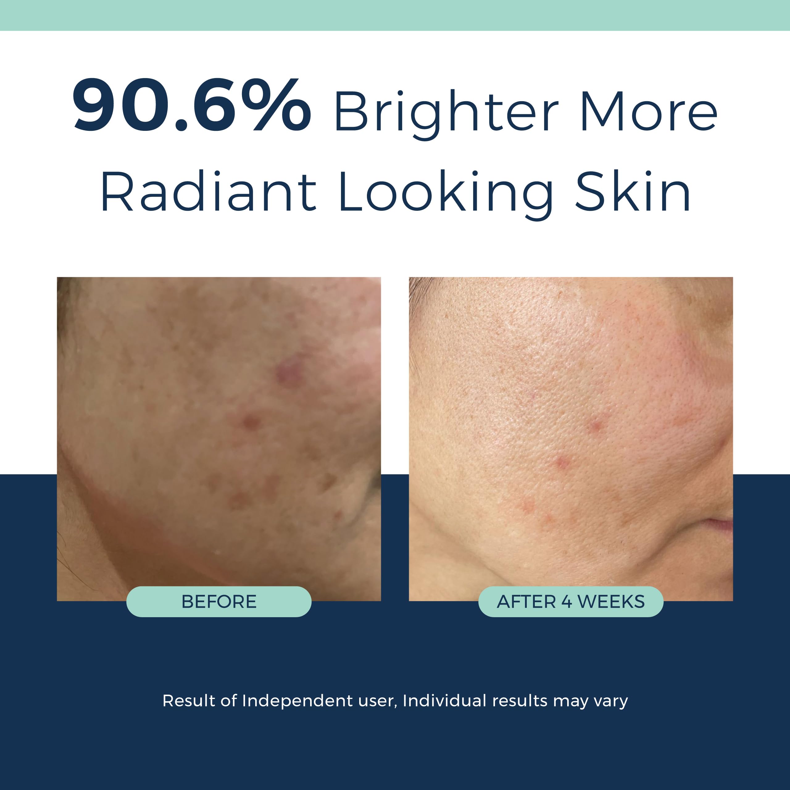 Clinexil Anti-Aging Retinol Collagen Serum for Face- 1% Encapsulated Retinol, Niacinamide & Hyaluronic Acid Improves Wrinkles, Hydration, Skin Texture. Gentle for Sensitive Skin-Fragrance Free-1 FL OZ