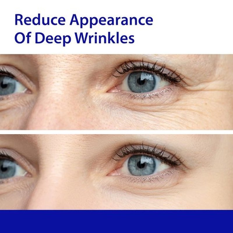 Dr. Denese SkinScience Firming Eye Cream - Collagen & Hyaluronic Acid for Smoother Under Eyes | 0.5oz