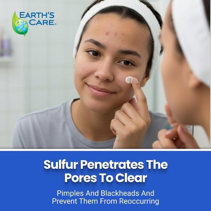 Earth's Care Acne Treatment Mask - 5% Sulfur Formula for Cystic Acne - 2.5 OZ Tube for Face Pimples & Blackheads