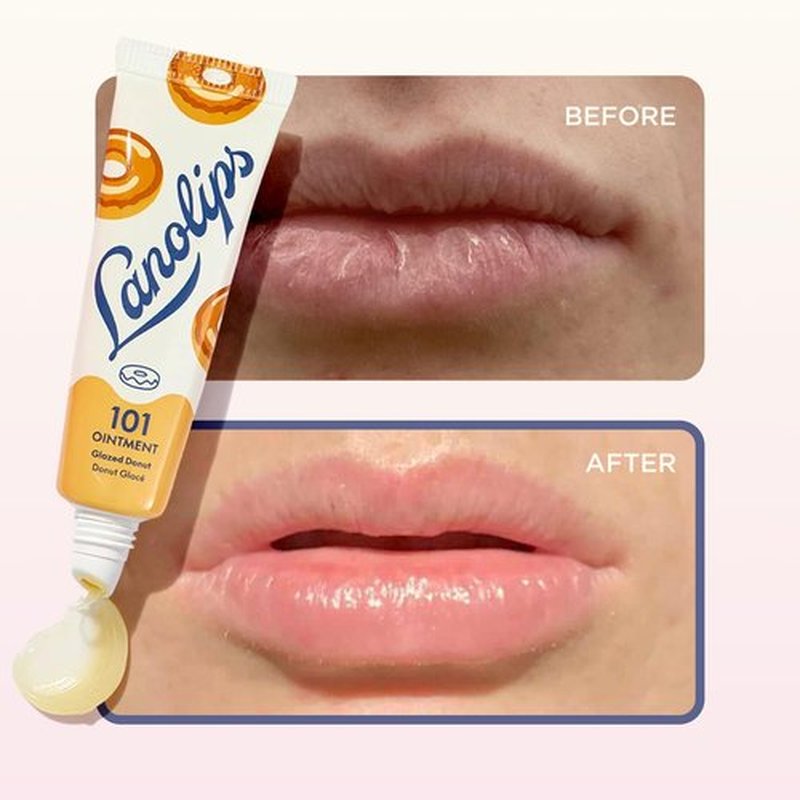 Lanolips 101 Ointment - Lanolin Lip Balm for Smooth, Hydrated & Healthy Lips - Multipurpose Lip Ointment with Lanolin Oil for Dry Lips, Cuticles & More - Glazed Donut (0.52 oz)