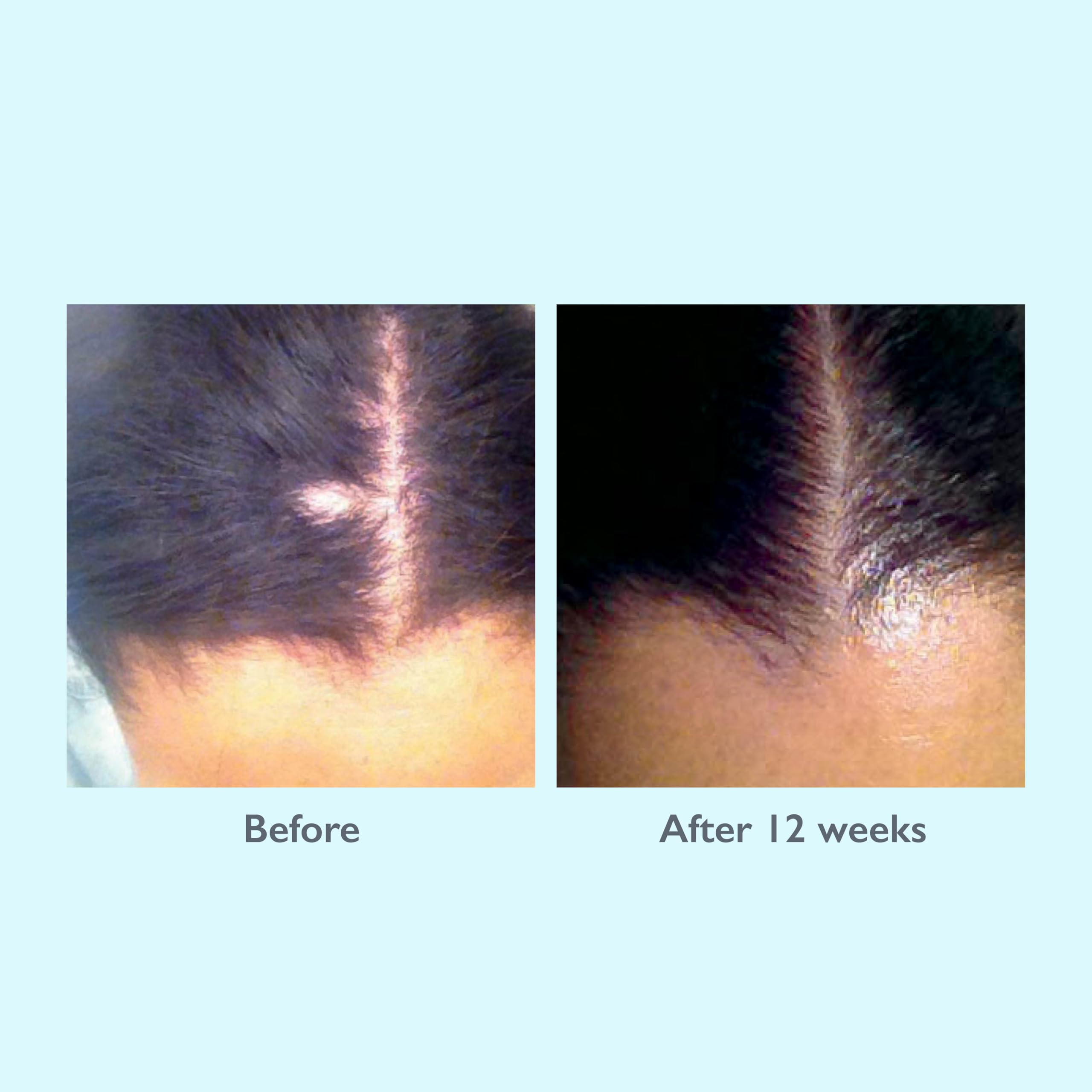 Revitalizing Scalp Treatment - 6.7FL OZ