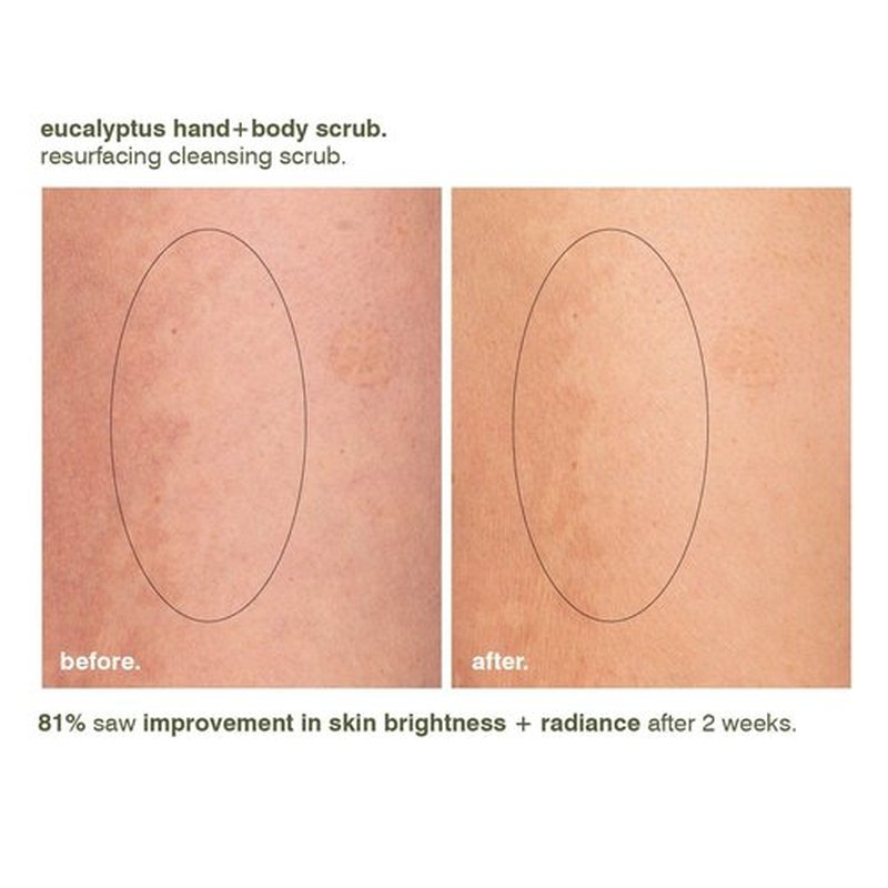 MALIN+GOETZ Eucalyptus Hand+Body Scrub | Resurfacing Cleanser Lactic Acid, Mandelic Acid, Pumice + Niacinamide | Deeply Cleanses, Smooths + Brightens | Vegan, Cruelty-Free, Paraben-Free (8.5 Fl Oz)