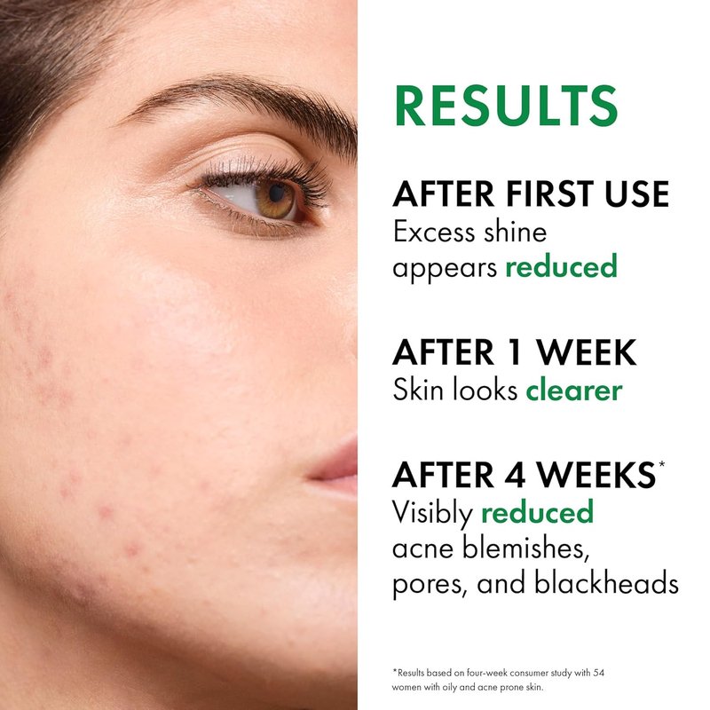 VICHY Normaderm Acne Face Wash - Salicylic Acid Cleanser for Oily Skin | Clears Clogged Pores & Blackheads