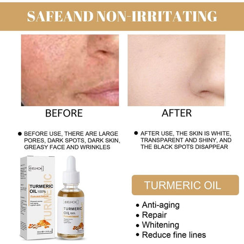 2 Pack Turmeric Dark Spot Corrector Serum, Natural Turmeric Dark Spot Corrector Serum for Face, Skin Care Moisturizing Repair (30mL/1.01 f.oz)