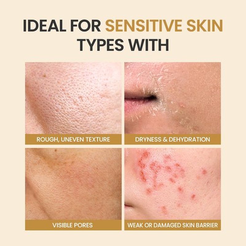 Toner Pads for Dry Dull Sensitive Skin Korean, #OOTD Retinol Ceramides Strengthen Skin Barrier Smoothing Hydrating, Toner Pad 70Pads 4.05oz 120ml