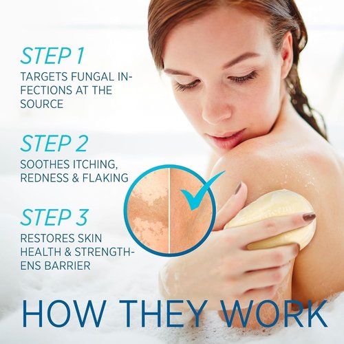 Tinea Versicolor Relief Cream & Soap Kit - Helps with Tinea Versicolor, Fungal Skin Conditions – Soothes, Cleanses, and Restores Skin Health