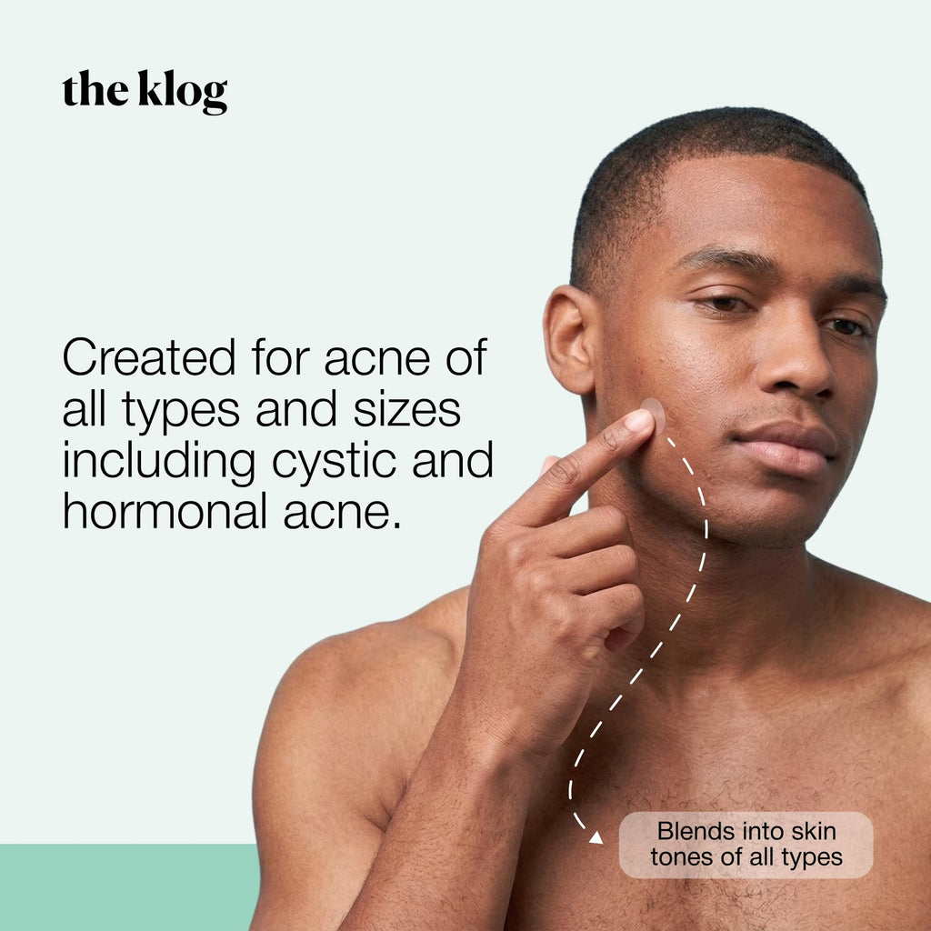 The Klog Soft Shield Pimple Patches by Soko Glam, Korean Facial Skin Care Hydrocolloid Acne Patches for Face & Body, Invisible Zit Stickers 10mm & 14mm, Vegan & Cruelty Free, 126 Dots (Pack of 3)