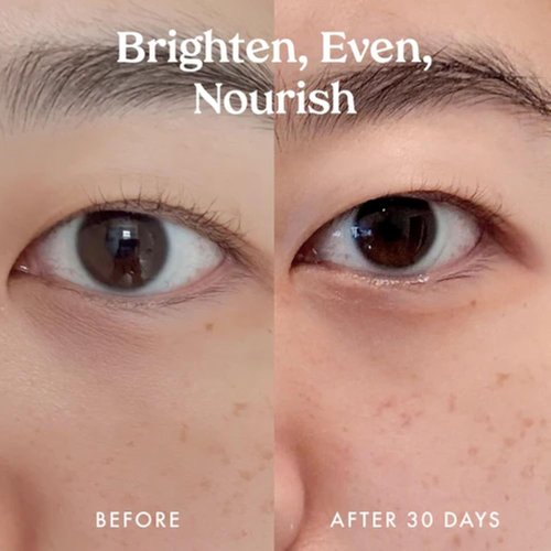Kopari Ceramide & Retinol Eye Balm - Hydrating Anti-Aging Treatment for Fine Lines & Puffiness - Encapsulated Retinol & Ceramides