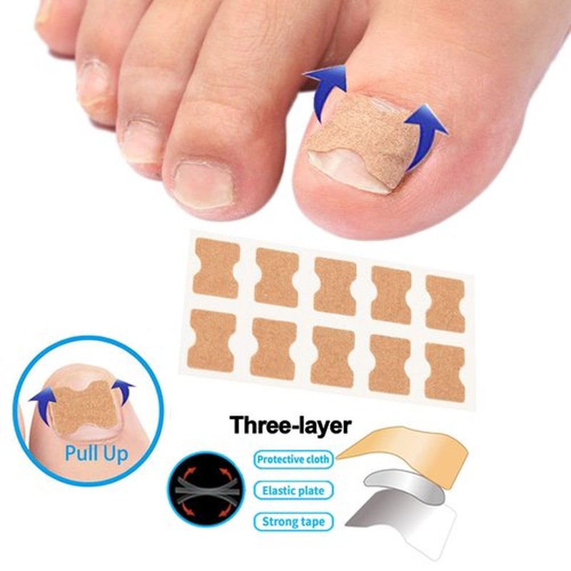 CHEMAILON Professional Ingrown Toenail Correction Kit - Stainless Steel Ingrown Toenail Clippers, Correction Patches, Lifter & Tools for Ingrown Toenail Treatment, Home Pedicure Solution