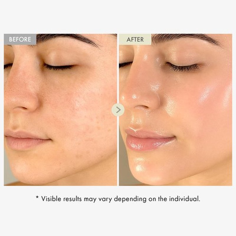 TOSOWOONG Real Collagen Face Serum, Hydrating & Firming Serum with hydrolyzed collagen, Hyaluronic Acid, Plumps, Sagging Skin, Reduces Fine Lines and Wrinkles, Korean Skincare, 33ml / 1.11 fl. oz.