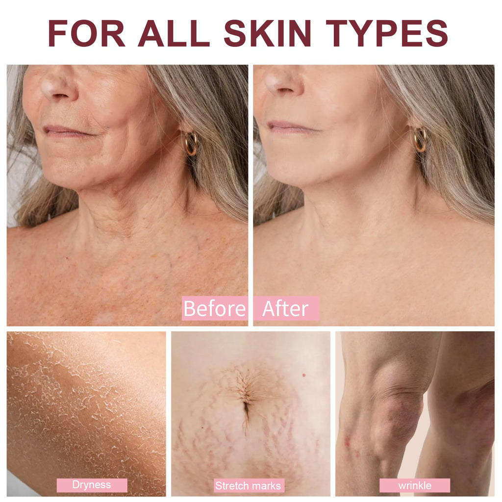 FloraDew+ Mythic Body Firming Oil Skin Tightening Body Oil After Shower for Women Tighten, Hydrate & Nourish Dry Skin 4 FL OZ