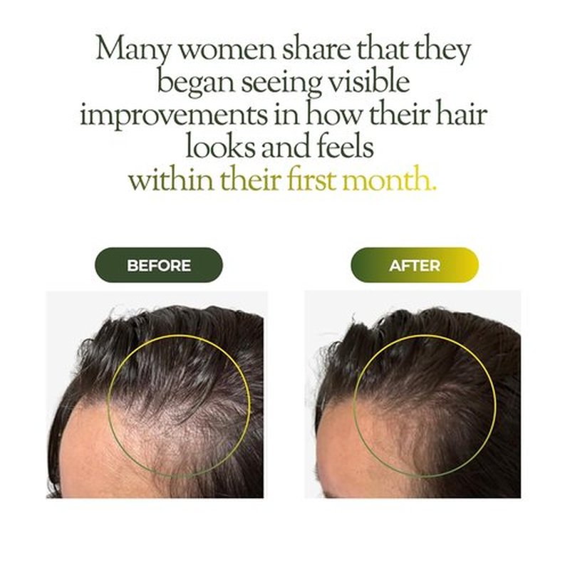 Regener8 Hair & Scalp Oil for Women - Natural Essential Oil Blend for Thinning Hair & Loss | Hormonal Support