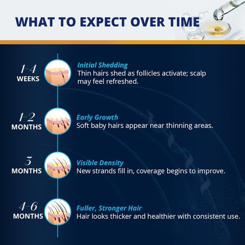 5% Minoxidil Hair and Beard Growth Kit: Extra Strength Minoxidil Topical Hair Regrowth Treatments Serum for Thinning Hair - Hair Loss Products for Men and Women