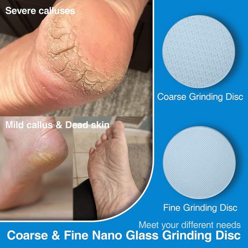 OZLICE 2 Pcs Nano Glass Sandpaper Disc for APRELM Electric Foot Callus Remover with 60 Pieces Replaceable Round Double-Sided Adhesive Pads Replaceable Sandpaper Disc