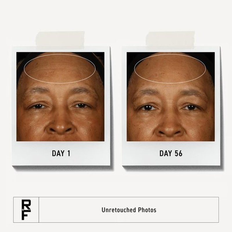 Rodan + Fields Redefine Regimen - Complete Skincare Kit with Clay Cleanser, Toner & Creams | Perfect Gift Set for Women