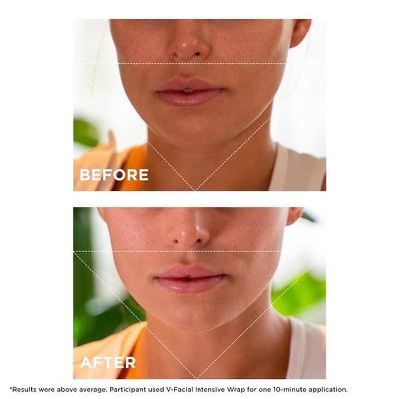 Clarins V-Facial Intensive Wrap Face Mask - Award-Winning Contouring Treatment | Reduces Puffiness & Swelling | 2.5 Oz
