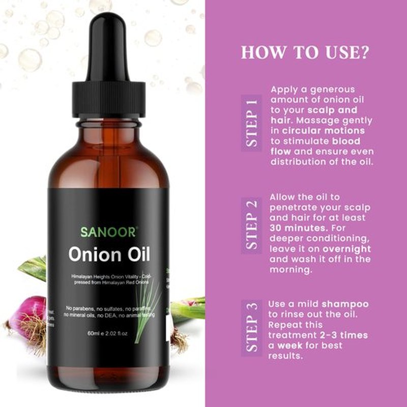 SANOOR Himalayan Red Onions Oil | 100% Pure (2.02oz)| Cold-pressed, stimulates hair growth, strengthens follicles, and treats infections for healthier hair | 60ml