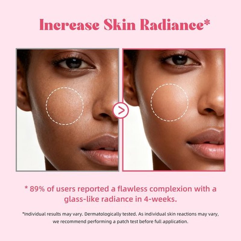ANRCOLLECT 5% Tranexamic Acid + 10% Niacinamide Serum for Tone Perfecting, Post-Acne Care, Radiant Glow - with Kojic Acid, Ceramides, Hyaluronic Acid - 30ML Vegan Skincare