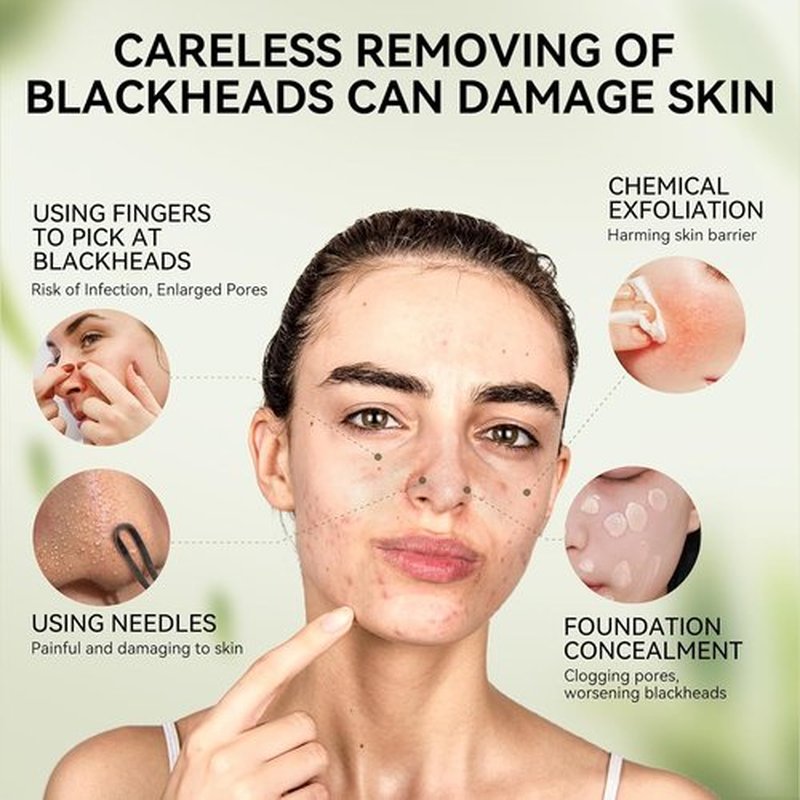 LANBENA Blackhead Remover - Bamboo Charcoal Peel-Off Mask & 60 Nose Strips for Deep Cleansing