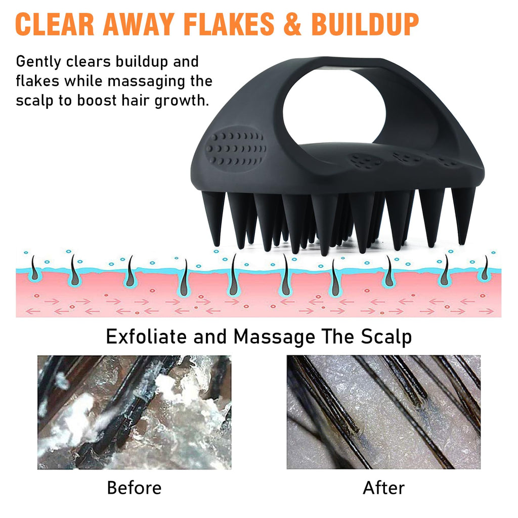 YEALIR Scalp Massager Shampoo Brush, Scalp Scrubber for Dandruff & Build Up, Scalp Massager Hair Growth - 100% Silicone, Plastic Free