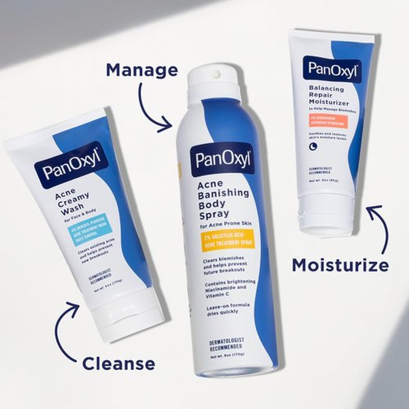 PanOxyl Acne Banishing Body Spray with 2% Salicylic Acid, Pimple Treatment Spray to Clear Stubborn Breakouts, 360-Degree Spray Nozzle, Skin-Brightening Niacinamide, Vitamin C, Witch Hazel, Aloe, 6 Oz
