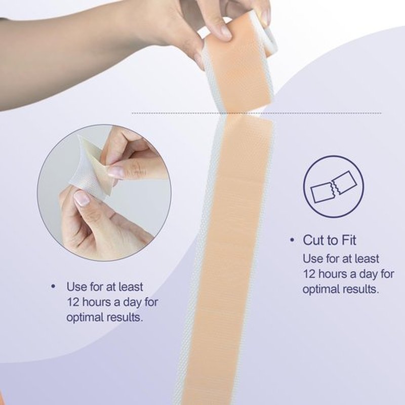 Ourmed Silicone Scar Removal Tape (1.6" x 120" Roll - 3M), Medical Grade Silicone Scar Removal Sheets, Hypoallergenic for New and Old Scars – Surgery, Burns, Acne, Keloids, Stretch Marks, C-Section