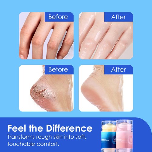 Crack Feet Prevention Stick (2-Pack) | Moisturizing Heel Balm & Foot Balm Stick for Dry, Cracked Feet | Anti-Crack Foot Cream Sticks for Softening, Nourishing, Smoothing Rough Heels & Dry Skin