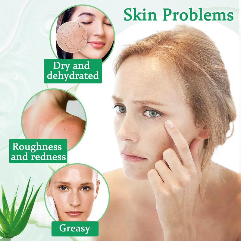 WENJLYJ 8PCS Aloe Vera Gel for Face & Skin,Organic Aloe Vera Gel,Hydrating After Sun Cream for Travel Size,Moisturizing Lotion for Skincare,After Sun Lotion for All Skin Type(A)