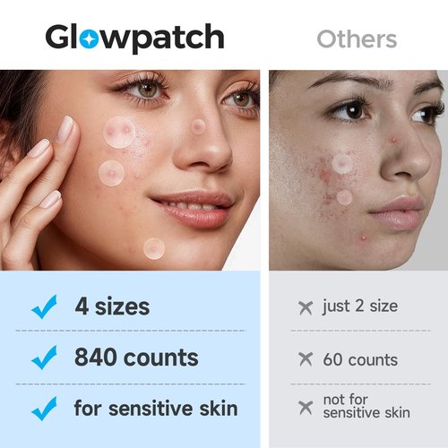 Glowpatch Acne Pimple Patch(840 Counts 4 Sizes), Zit Stickers for Face, Hydrocolloid Spot Stickers, Clear Acne Dots for Covering Zits, Blemishes, and Breakouts