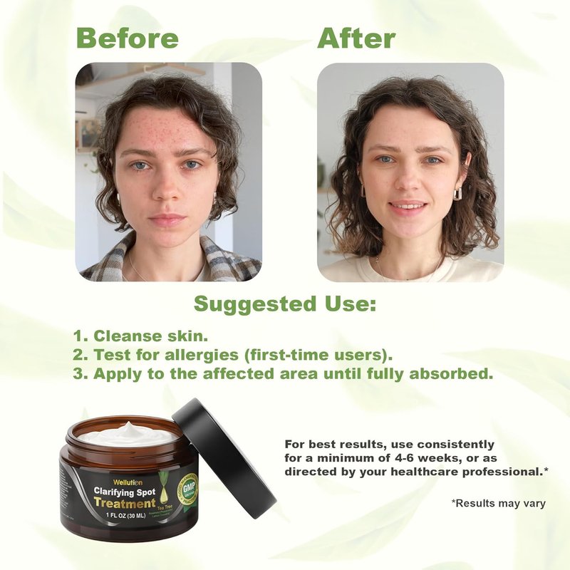 WELLUTION Cystic Acne Spot Treatment - Fast-Acting Tea Tree Acne Cream for Pimples & Blemishes - 1oz