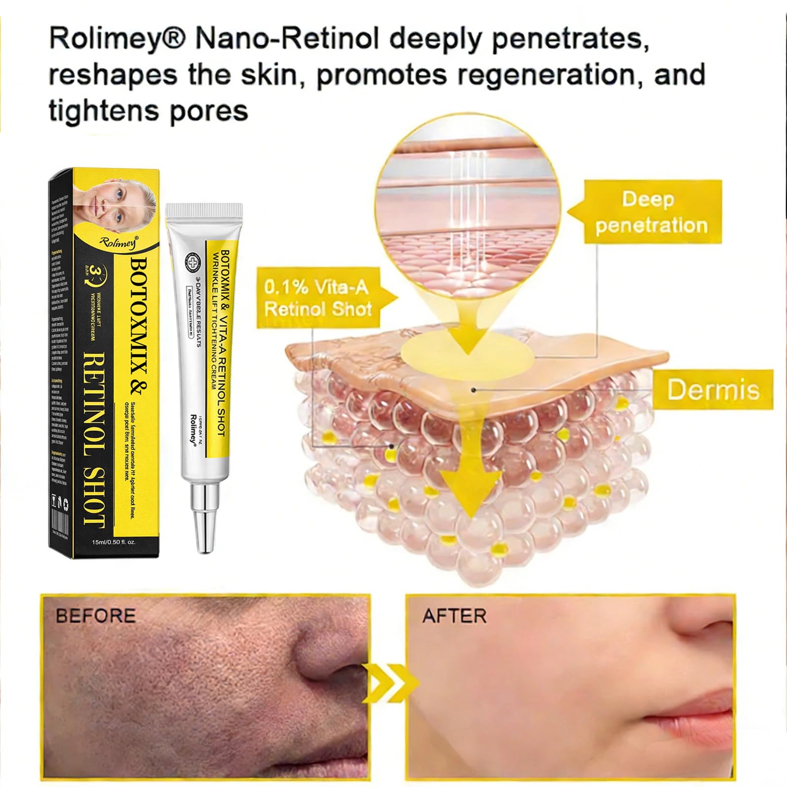 Rolimey Wrinkle-Liftt Botoxmix & Vita A Retinol Shot Tightening cream, Retinol Shot Wrinkle-Lift Tightening Cream, Lift and Tighten Skin, Deeply Moisturize (1PC)