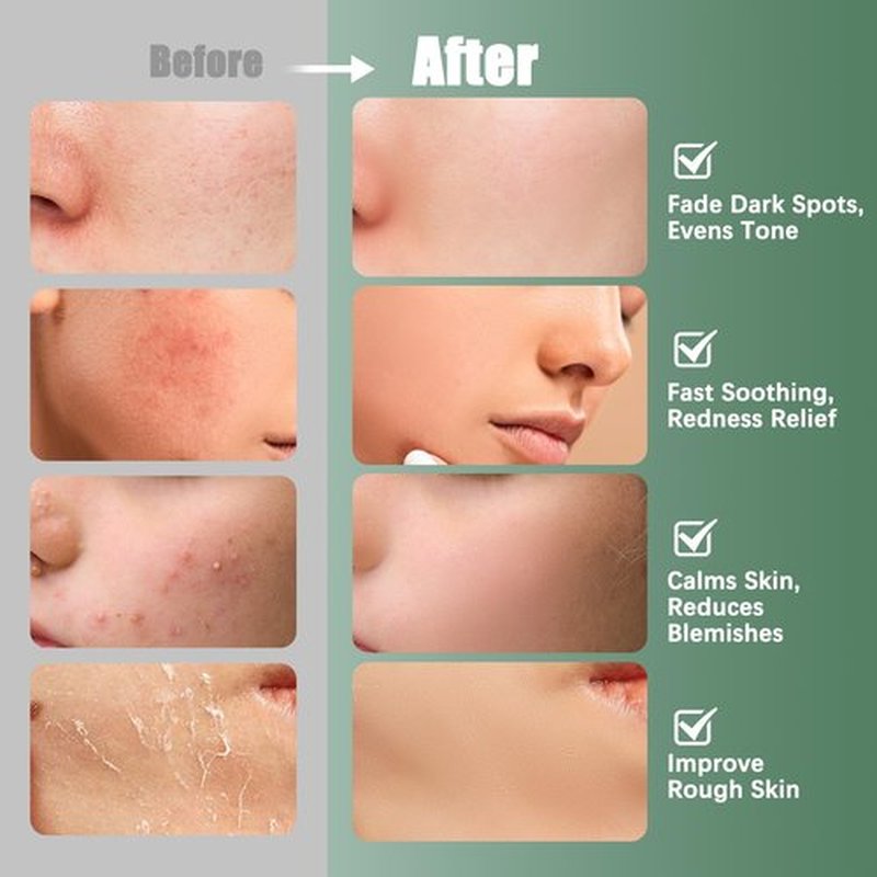 Kestper Madecassoside & Caffeine Toner Pads|Soothe Redness,Strengthen Barrier & Refine Pores with Centella Asiatica,Niacinamide | 110 Pads for All Skin Types
