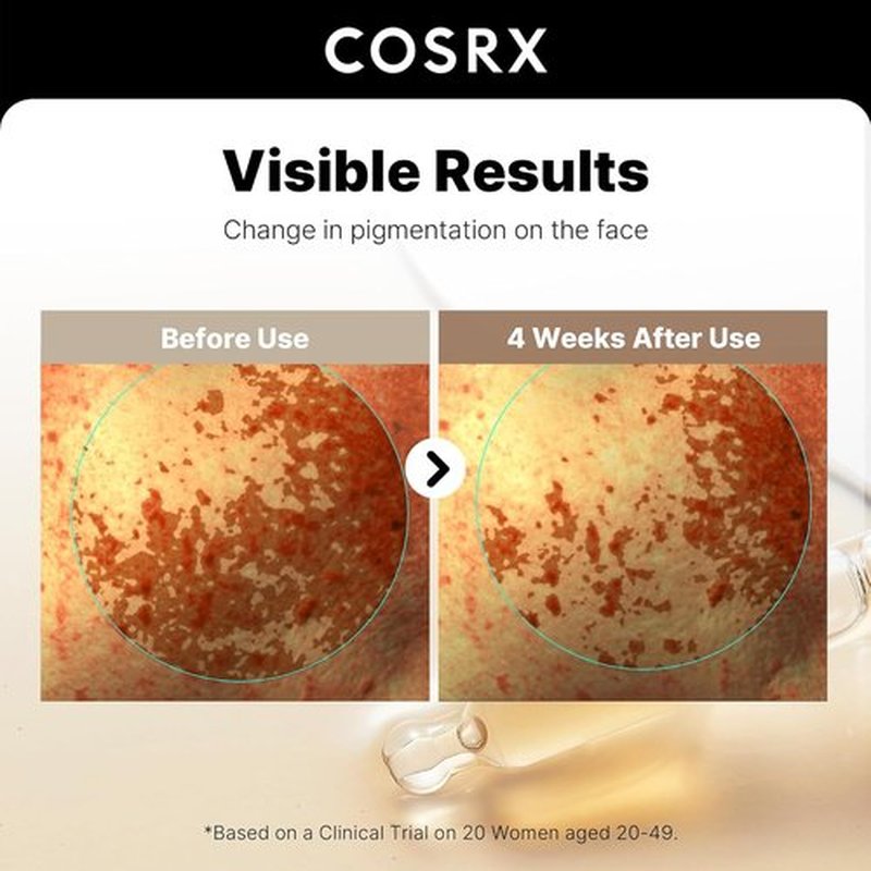 COSRX 2% Alpha Arbutin Face Serum - Dark Spot & Uneven Tone Care with Niacinamide | 1.7 fl oz