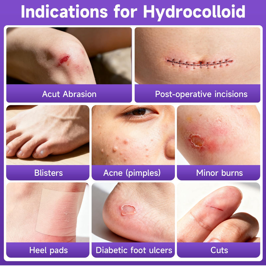 Hydrocolloid Roll for Wound Care, Hydrocolloid Bandages with Self-Adhesive, Flexible & Waterproof DIY Size & Shape (3.6)