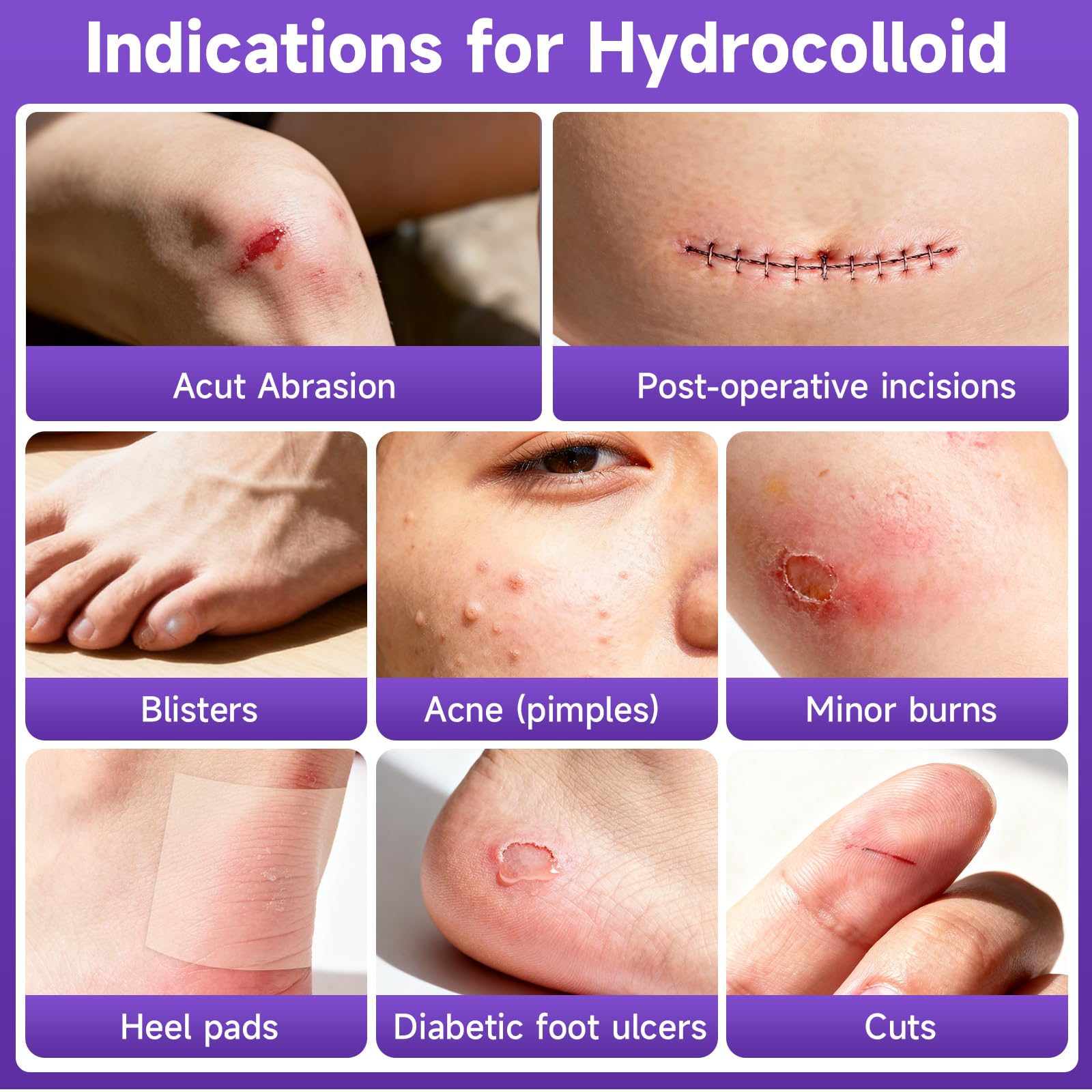 Hydrocolloid Roll for Wound Care, Hydrocolloid Bandages with Self-Adhesive, Flexible & Waterproof DIY Size & Shape (3.6)