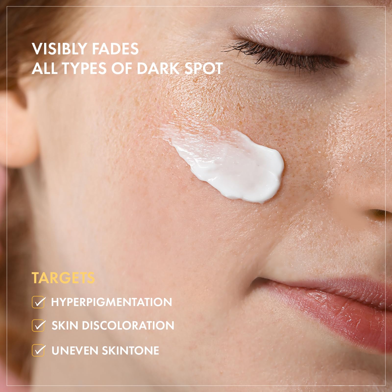 TOSOWOONG 8 Days Spot Cream, Dark Spot Remover for Face, Age Spot, Sun Spot, Freckles, Melasma, Brown Spot Serum, Advanced Formula Corrector Cream with Niacinamide for Women and Men, 50g, 1.76 oz.