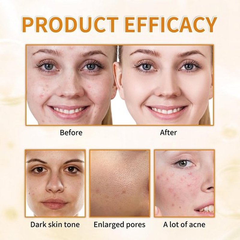 7% Glycolic Acid Exfoliating Toner, Exfoliating Facial Toner, Pore Minimizing Toner, Smooth Skin, Even Tone, Hydrating Formula