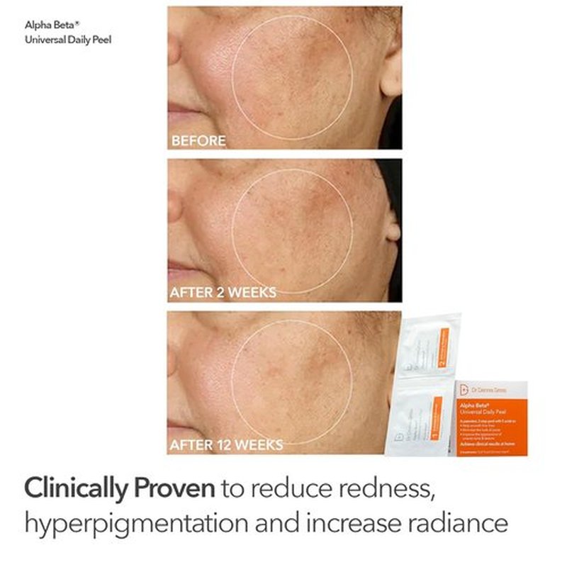 Dr. Dennis Gross Plump & Smooth Kit - DermInfusions™ Blur & Repair Cream (0.67 oz) + 5 Alpha Beta® Peels | $50 Value