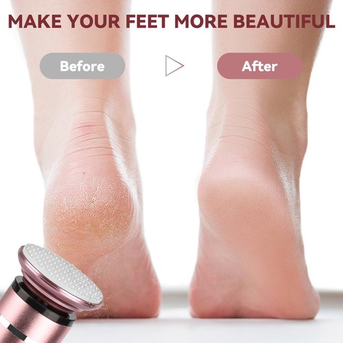 Electric Foot Callus Remover Cordless, 3 Adjustable Speed Foot File with 4 Nano Glass Grinding Disc, Professional Pedicure Tool Foot Scrubber for Heel Dead Skin and Calluses