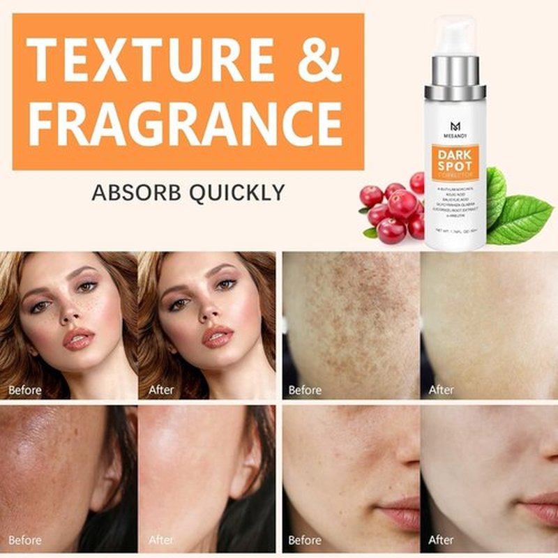 Skiennix Dark Spot Remover - 5% Niacinamide & Hyaluronic Acid Fade Cream for All Skin Types