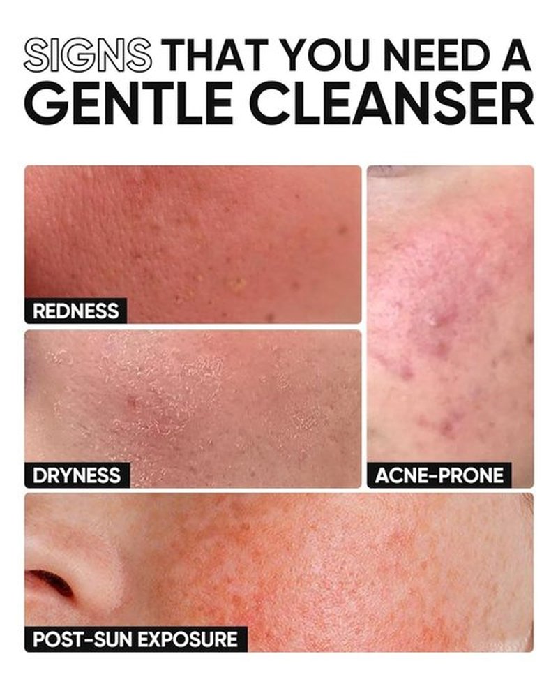 SKINTIFIC 5X Ceramide Facial Cleanser - Gentle Hydrating Face Wash with Hyaluronic Acid for Sensitive Skin