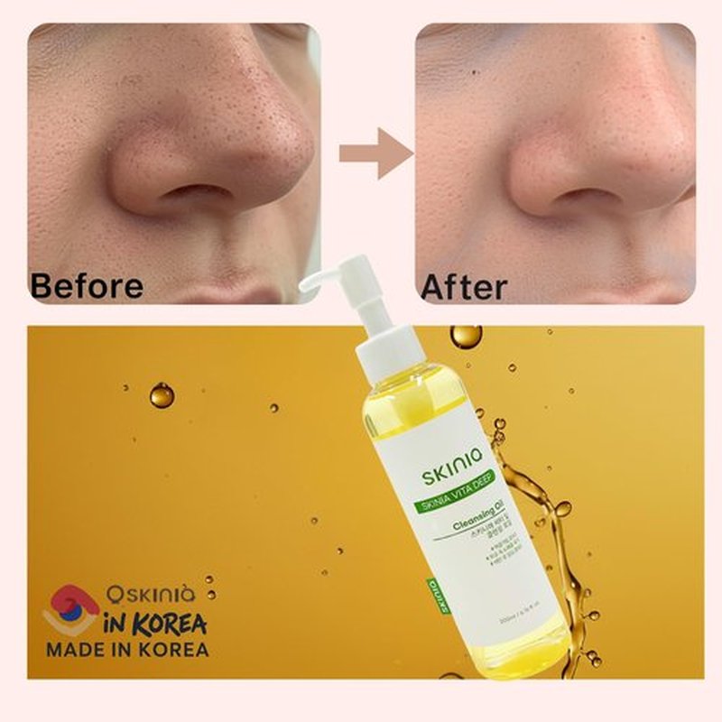 Skinia Vita deep Cleansing Oil for Face, Makeup Blackhead Remover, Korean Skin Care, 6.76 fl oz