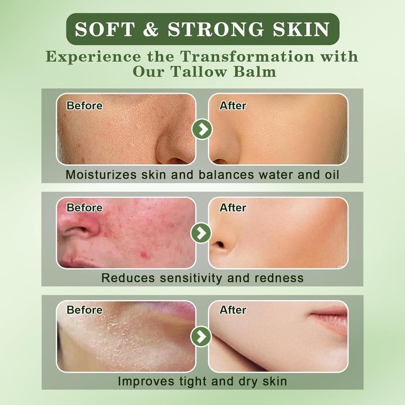 WEILNELL Beef Tallow and Honey Balm for Skin - All-Natural Moisturizer Hydrates and Nourishes the Skin, Grass-Fed Beef Tallow & Honey Balm Blend, Deeply Moisturizing for Face & Body Natural Skin Care