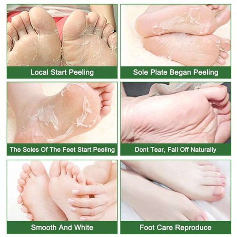 Foot Peel Mask 5 Pack, Skin Exfoliating Foot Masks, Natural Exfoliator for Dry, Callus, Dead Skin Remover, Repair Rough Heels Feet Peeling Mask for Men Women (Tea Tree Scent)
